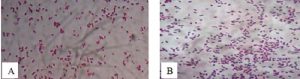 Vi khuẩn thu thập từ cá hồi nuôi tại Lâm Đồng: Tiêu bản nhuộm gram vi khuẩn A. hydrophyla (A), vi khuẩn B. Cepacia (B)